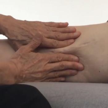 Rolﬁng® und Narben